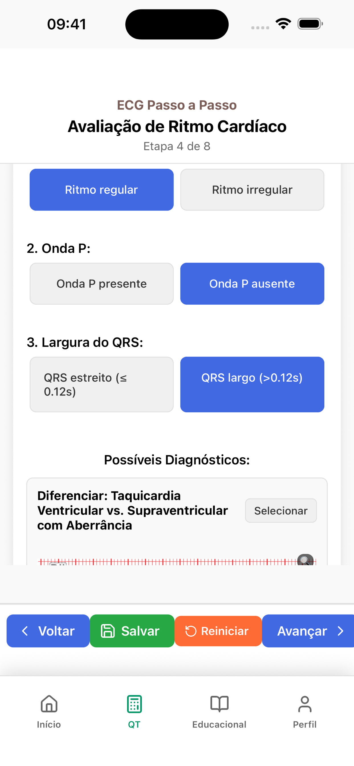 Fluxo de arritmias do ECG WM